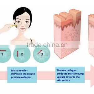 Factory Supply Lumsail Micro Needles Meso Beauty Skin Derma Roller thumbnail-6