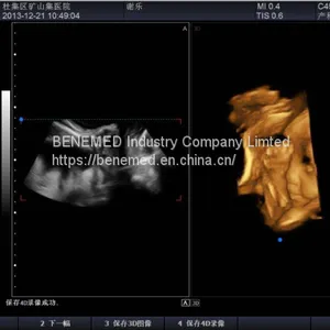 Trolly Based Color Doppler System Ultrasound Diagnostic Scanner thumbnail-4