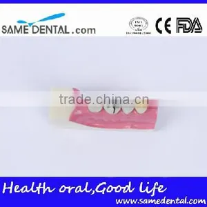 Right Tooth Tissue Decomposition Model Dental Eduction Assitant No. DEA-17 thumbnail-1