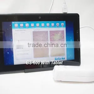 Mini Skin and Hair Analysis Machine for Sale thumbnail-2