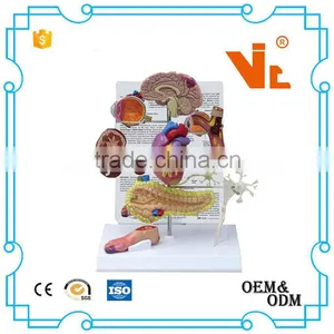 V-AM034 Type II Diabetes Model Set thumbnail-1