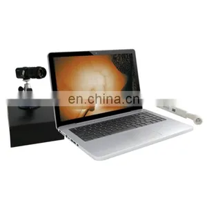 High Quality Infrared Detection Breast Disease Diagnosis Machine for Breast Detection thumbnail-1
