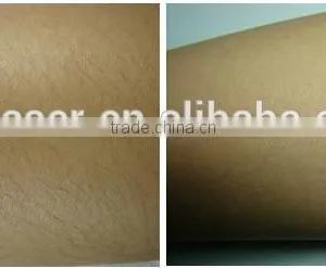 Best Thermostatic Water Cycle System 808nm Diode Laser thumbnail-5
