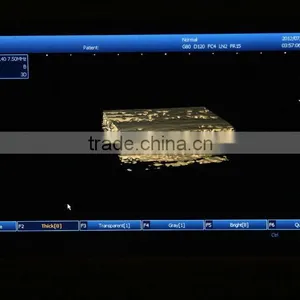 2016 New Laptop Ultrasound Machine / Scanner PC Platform With CE ISO Certification thumbnail-4