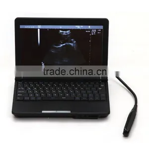2016 New Veterinary Full Digital Laptop Ultrasound Machine With Low Price thumbnail-2