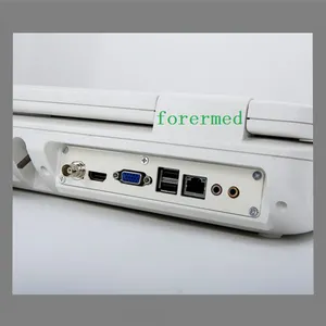 Portable Ultrasound Color Doppler Gynaecology Ultrasound thumbnail-5