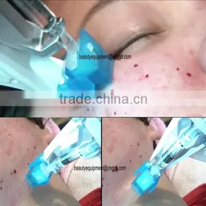 Professional Mesogun Injector for Hair Pore Shrink and Neck Wrinkle Improvement thumbnail-6