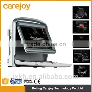 Portable Ultrasound Scanner Color Doppler Ultrasound System thumbnail-1