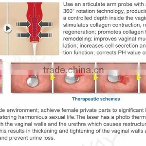 Painless Portable 2016 Newest Laser Beauty Equipment Pixel Rf Co2 Fractional Laser For Stretch Marks Removal 10.6um Fine Lines Removal thumbnail-6