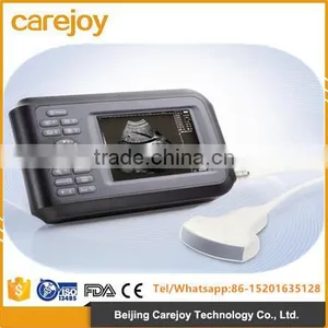 2015 New Handheld Ultrasound Scanner on Sale thumbnail-1