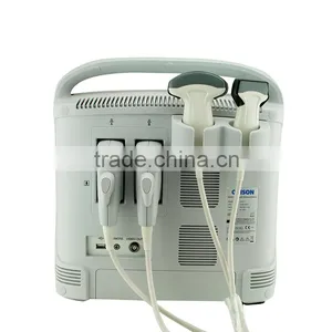 Medical Equipment Portable Color Doppler Ultrasound Scanner System With Cheap Price thumbnail-4