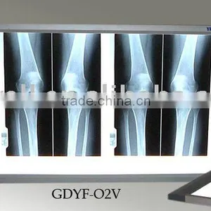 X-Ray Film Viewer thumbnail-1