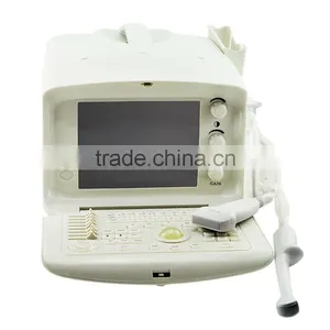 Cheap Prices of Medical Ultrasound Machine for Pregnancy thumbnail-3