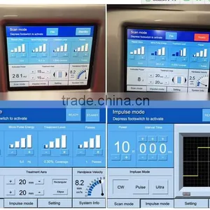 Birth Mark Removal Sanhe Best Quality Multifunction Dermatology Sc-2 10600nm 10600 Nm Laser Co2 Fractional Machine/co2 Freckle Removal Device thumbnail-4