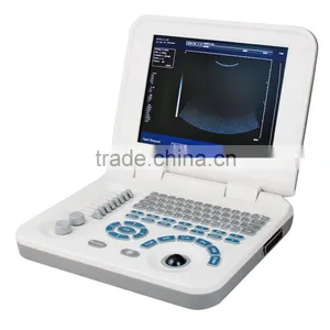 RUS-9000F2 CE&ISO Easy Carrying Portable Ultrasound Scanner Price thumbnail-3
