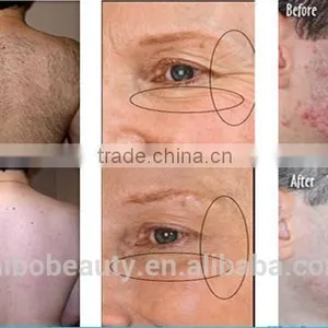 Pain-Free Professional Dual System Permanent Hair Removal/ipl Bode Shr Skin Rejuvenation Tightening Wrinkle Removal/SHR Diode Laser thumbnail-6