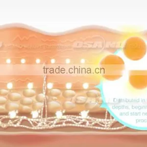 Multi-polar RF 2016 Newest Chest Shaping Medical HIFU Machine/HIFU Face Lift thumbnail-5
