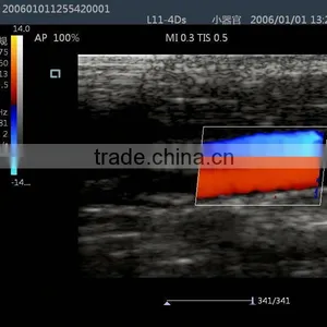 Laptop Color Doppler Ultrasound Syatem With Transducers thumbnail-4