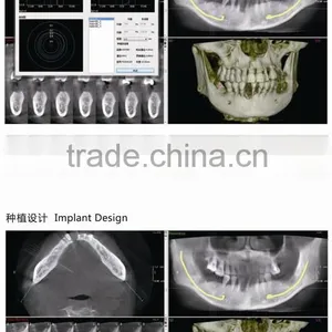 Digital 3D Intra-oral Imaging X-ray Machine thumbnail-2