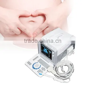 Hot Recommend Cheap Price Portable Ultrasound Scanner/Machine With Convex, Linear Probe/Transducers and Sony Printer RUS-6000D thumbnail-6