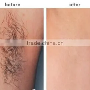 Tattoo Removal System 2016 Latest Professional Multifunctional Ipl Shr Laser System Pigmented Lesions Treatment Nd Yag Laser Hair And Tattoo Removal Beauty Machine thumbnail-5