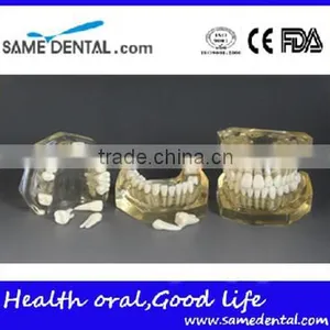 Dental Detachable Transparent Dentition Model DEA-47 thumbnail-1