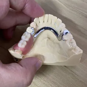 Dental Lab Mk1 Precision Attached Dentures Are Beautiful And Natural thumbnail-2