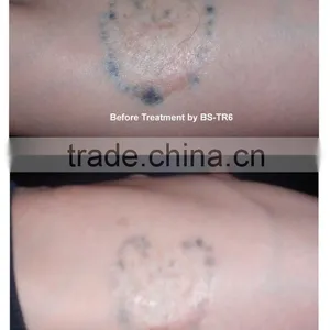 1-10Hz E-light IPL Rf Nd Yag Laser / Multifunction Machine Nd Yag Laser Freckles Removal thumbnail-3
