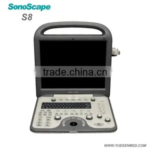 Portable Ultrasound Scanner Veterinary Sonoscape a5 Vet thumbnail-5