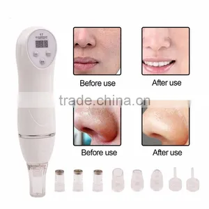 2017 Professional Portable Diamond Microdermabrasion Machine Used Beauty Salon Equipment Mini Skin Diamond Peeling Machine thumbnail-1