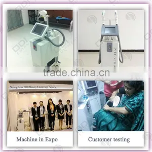 2015 High Performance Good Diode Laser for Hair Removal 808nm Beauty Machine With CE Certificate thumbnail-3