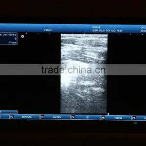 Laptop Ultrasound Scanner With 3D Function thumbnail-2