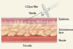 Hot in India Carboxy Treatment , Carboxy Treatment Equipment thumbnail-6