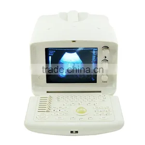 Carejoy Cheapest Portable Ultrasound Machine With Multi Frequency Probe SONY UP-898MD Video Thermal Recorder Optional thumbnail-2