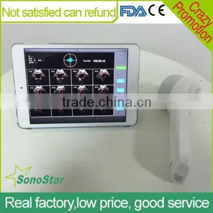 Sonostar New 3D 4D Laptop Ultrasound Scanner Ipad Ultrasound Scanner for Sale BProbe-2 thumbnail-1