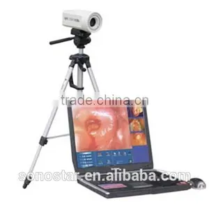 SVC-50 Colposcope(10) thumbnail-1