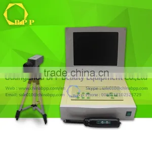 Infrared Mammary Gland Diseases Detector Women Breast Biopsy Analyzer Machine thumbnail-1
