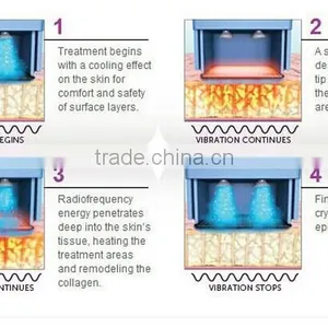 TRF-01 Non Invasive RF Machine Skin Tightening Device for Home Use thumbnail-3