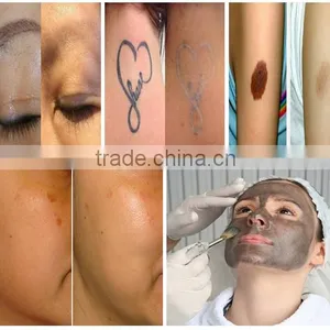 NEW Technology High Power Hair Removal E-light Ipl rf nd Yag Laser Multifunction Machine thumbnail-5