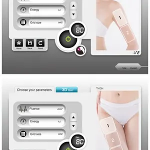 Alma Laser Soprano Platinum 808nm 755nm 1064nm Diode Laser Hair Removal Technology thumbnail-5