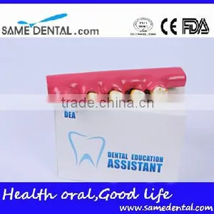 2x Periodontal Disease Classification Models Dental Eduction Assitant No. DEA-20 thumbnail-4
