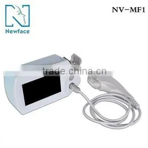 Equipment for Aesthetic Used MF1 Mini Hifu thumbnail-1