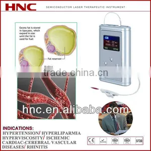 Acupoint Medical Equipment Intranasal Laser Nasosinusitis Treatment Instrument thumbnail-1