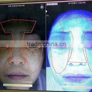 3D Facial Skin Analyzer for Skin Spots Wrinkle Pore Skin Color Analysis P-105B thumbnail-3