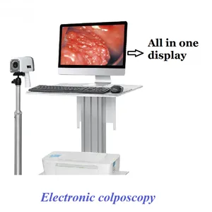 High Definition Digital Electronic Colposcope thumbnail-2