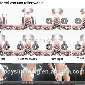Vacuum Roller Body Facial Vacuum Suction Machine thumbnail-5