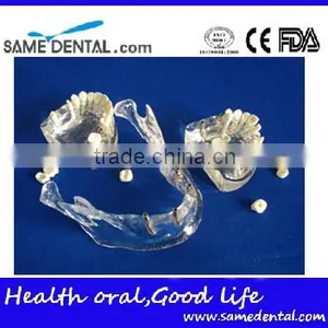 Hot Sale Transparant Mandibule Implant Model thumbnail-3