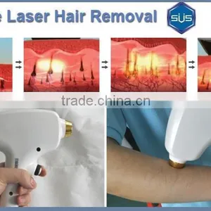 Latest Technology 808nm Diode Laser Hair Removal Home Machine thumbnail-5
