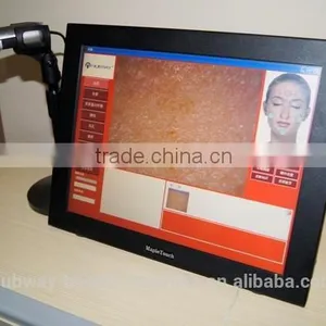 Professional Made in Taiwan Skin Magnifier Portable Skin Analysis Equipment thumbnail-3
