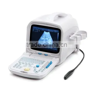 RUS-9000A PC Based Portable Ultrasound /Cheap Ultrasound Scanner/Machine 3.5Mhz Multi-frequency Convex Probe-Shelly thumbnail-4